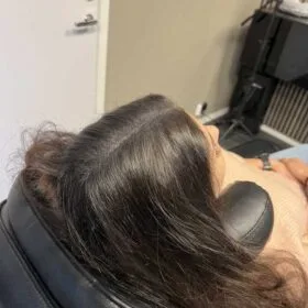 Håravfall | Hårutfyllnad kvinna mitten & hjässa Scalp Micropigmentation på kvinna, 34 år, utförd hos Made Hair Academy Stockholm– toppval inom scalp micropigmentation i Sverige