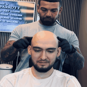 SMP för män i Göteborg och Stockholm | Made Hair Academy – ledande i Sverige inom naturlig hårpigmentering