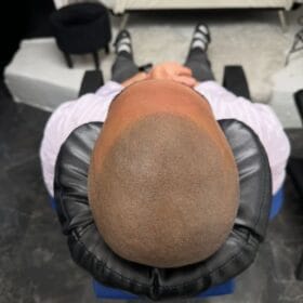 Hårpigmentering på man, 34 år, hos Made Hair Academy stockholm – ledande klinik för scalp micropigmentation i Sverige
