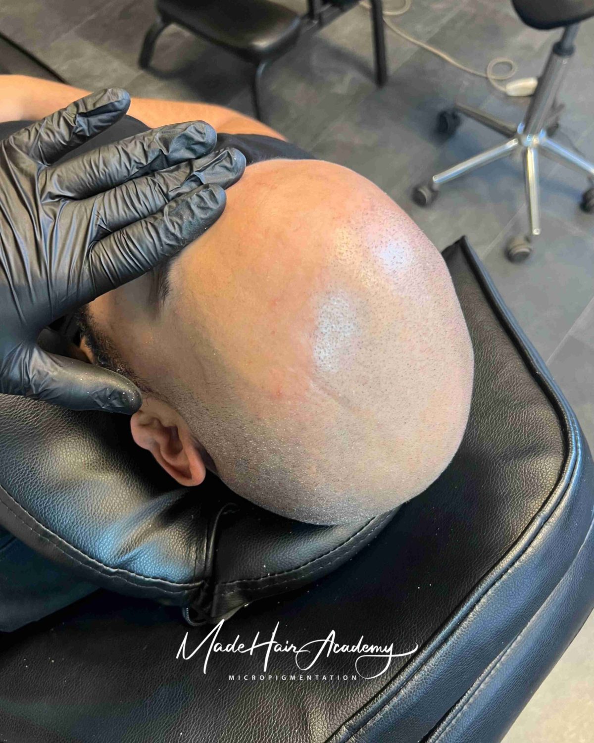 Hårpigmentering för man, 38 år – före/efter från Made Hair Academy Göteborg