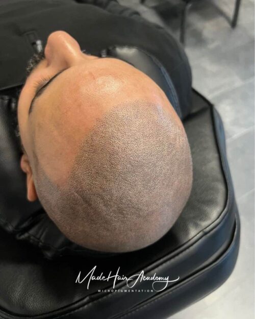 Hårpigmentering för man, 42 år, utförd hos Made Hair Academy Göteborg – ledande studio för hårpigmentering i Sverige