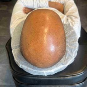 Hårpigmentering för man, 42 år, utförd hos Made Hair Academy Stockholm – ledande studio för diskret hårtatuering i Sverige