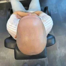 Hårpigmentering med precision för man, utförd hos Made Hair Academy Göteborg – ledande klinik inom diskret hårtatuering i Sverige