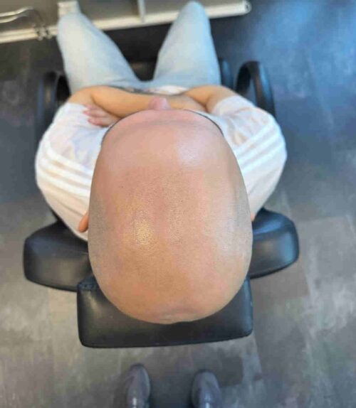 Hårpigmentering för man, 47 år, utförd hos Made Hair Academy Göteborg – ledande klinik inom diskret hårtatuering i Sverige
