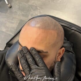 Kontakt SMP för män i Göteborg och Stockholm | hårpigmentering som skapar en tät och naturlig rakad look hos Made Hair Academy