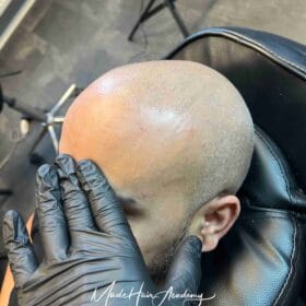 Scalp Micropigmentation på man, 38 år, hos Made Hair Academy stockholm – ledande klinik för scalp micropigmentation i Sverige