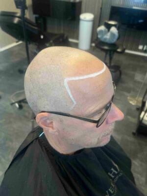 Närbild av hårpigmentering i Stockholm som visar realistiska pigmentpunkter i hårbotten. Diskret och naturligt resultat