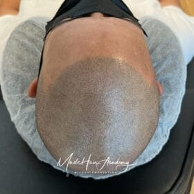 Hårtatuering | huvud tatuering | tatuera hårbotten