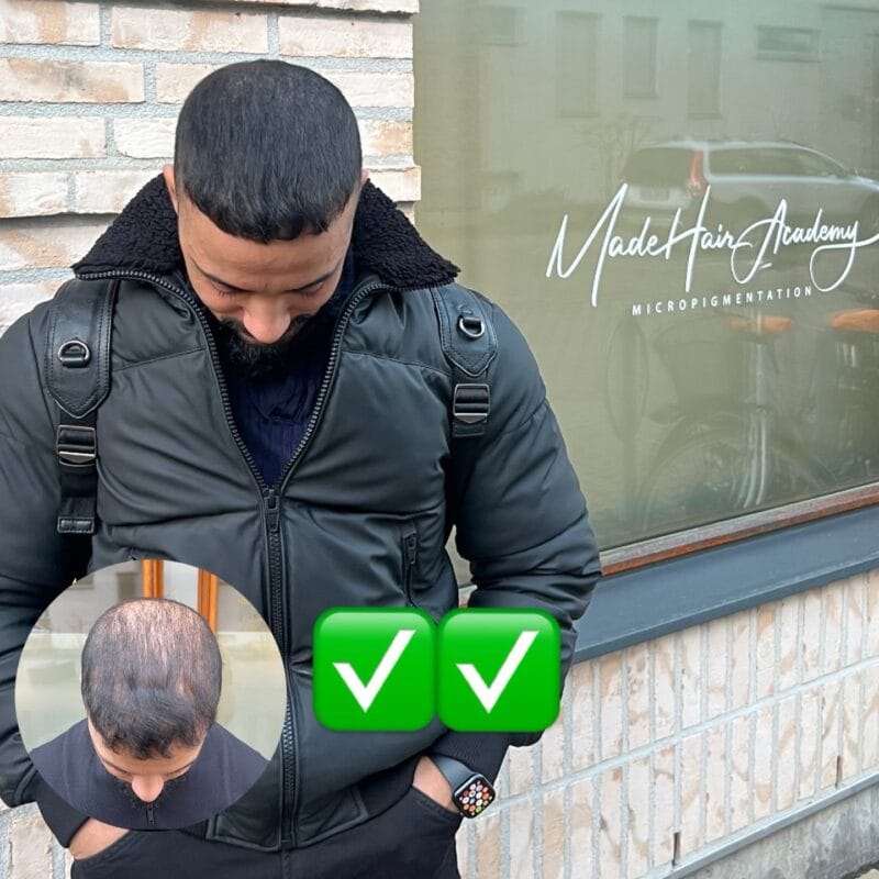 10 anledningar varför du ska välja scalp micropigmentation. SMP utbildning hos Made Hair Academy
