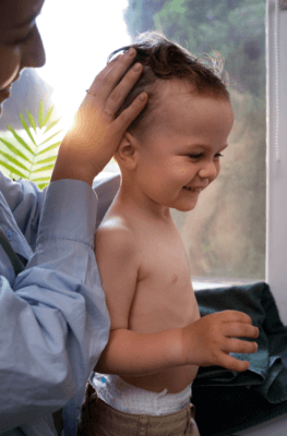 Alopecia areata barn symptom