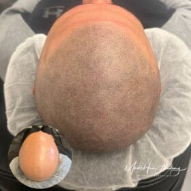 Tatuera hårbotten hos Made hair academy från 4.500 kr per behandling