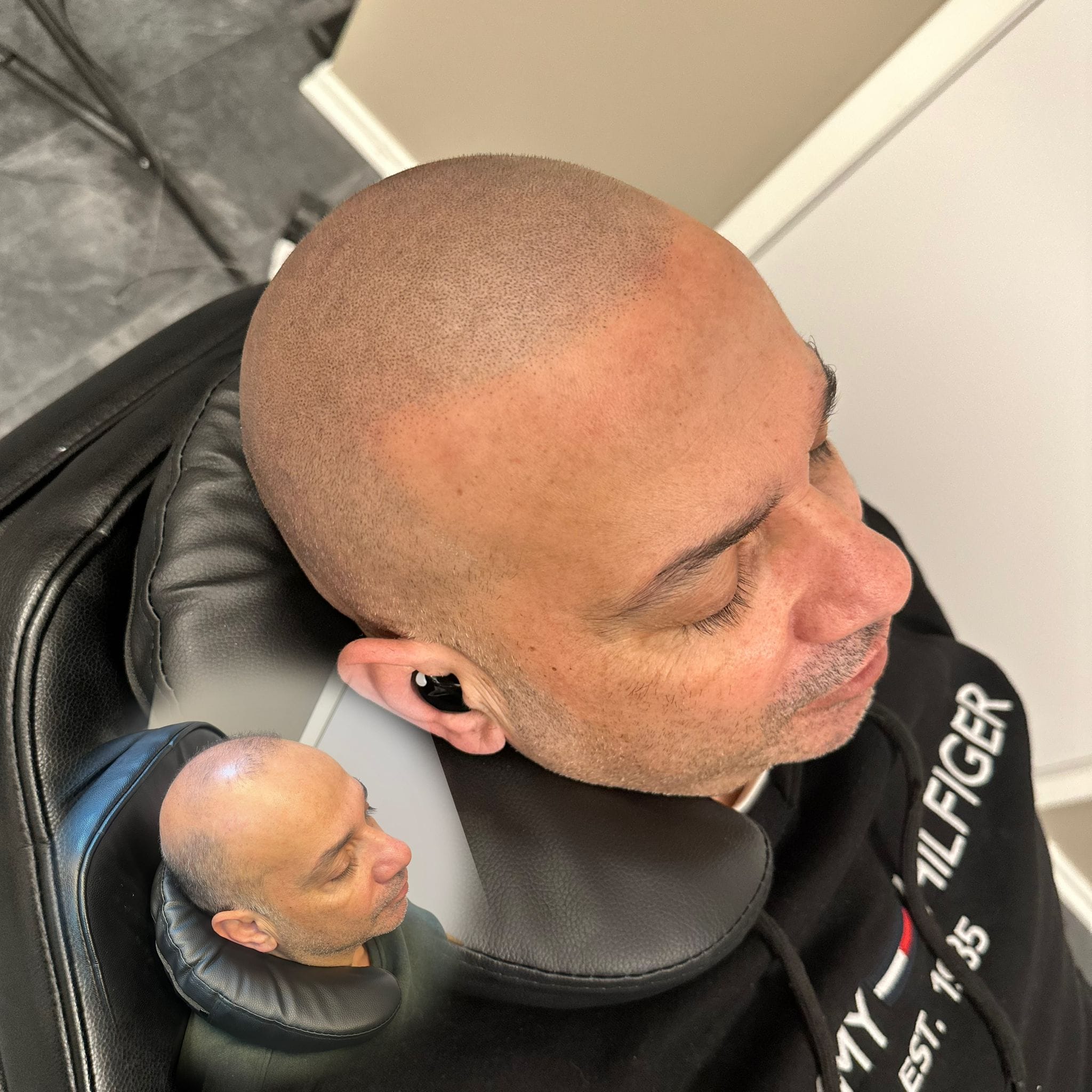 Full scalp SMP hos Made Hair Academy